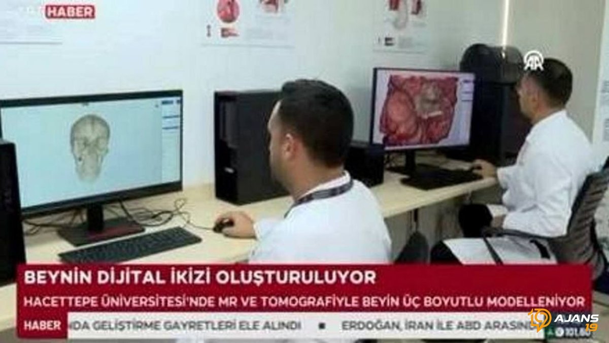 Hacettepe'den Tarihi Adım: Cerrahi Hazırlığı Devrim Yaratan Yerli Teknolojiyle Yeniden Tanımlıyor!